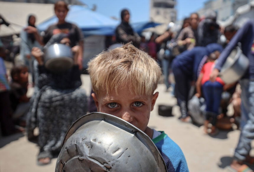 Malnutrition photo in Gaza